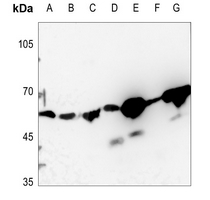 1 - Anti-DQX1 Antibody AP60127