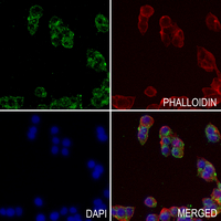 3 - Anti-Adenylate Cyclase 4 Antibody AP60128