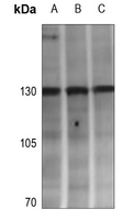 1 - Anti-Adenylate Cyclase 4 Antibody AP60128