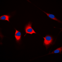 3 - Anti-CDKL4 Antibody AP60129