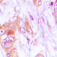 19 - Anti-CDKL4 Antibody AP60129