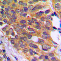 19 - Anti-EEF2K (Phospho-S366) Antibody AP60130