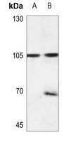 1 - Anti-EEF2K (Phospho-S366) Antibody AP60130
