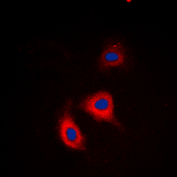 3 - Anti-Alpha-adducin (Phospho-S726/713) Antibody AP60131
