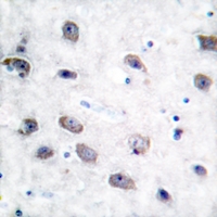 19 - Anti-Alpha-adducin (Phospho-S726/713) Antibody AP60131