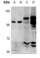 1 - Anti-Alpha-adducin (Phospho-S726/713) Antibody AP60131