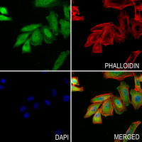 3 - Anti-SMAD2/3 (Phospho-T8) Antibody AP60132
