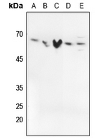 1 - Anti-SMAD2/3 (Phospho-T8) Antibody AP60132