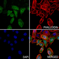3 - Anti-STAT5 Antibody AP60133