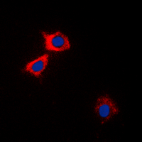 3 - Anti-CaMK2 alpha/delta Antibody AP60135