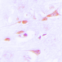 19 - Anti-CaMK2 alpha/delta Antibody AP60135