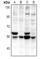 1 - Anti-CaMK2 alpha/delta Antibody AP60135