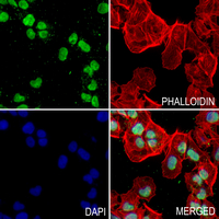 3 - Anti-hnRNP LL Antibody AP60136