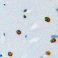 19 - Anti-hnRNP LL Antibody AP60136
