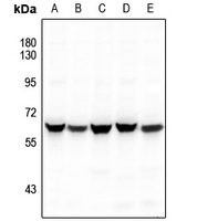 1 - Anti-hnRNP LL Antibody AP60136