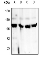 1 - Anti-Factor B Antibody AP60137