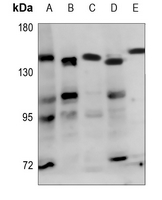 1 - Anti-ADAMTS18 Antibody AP60138