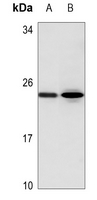 1 - Anti-AID Antibody AP60139