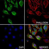 3 - Anti-ANGPTL3 Antibody AP60140