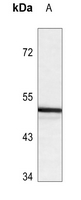 1 - Anti-ANGPTL3 Antibody AP60140