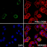 3 - Anti-ANKRD20A1 Antibody AP60141