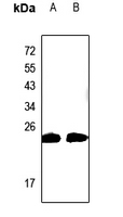 1 - Anti-CABP2 Antibody AP60144