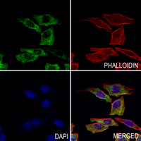 3 - Anti-CAPNS2 Antibody AP60145