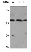 1 - Anti-CAPNS2 Antibody AP60145