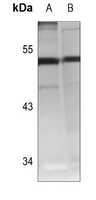1 - Anti-Cathepsin A 20k Antibody AP60146