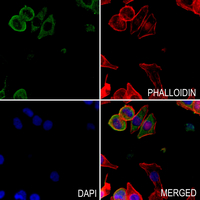 3 - Anti-Cathepsin C LC Antibody AP60147