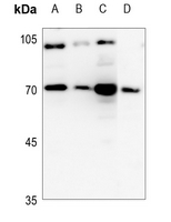 1 - Anti-Cathepsin C LC Antibody AP60147