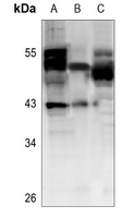 1 - Anti-Cathepsin F Antibody AP60148