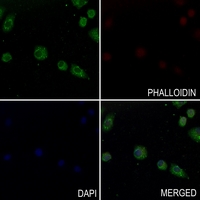3 - Anti-CATSPER1 Antibody AP60149