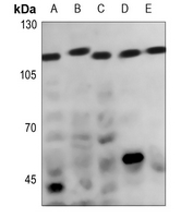 1 - Anti-CATSPER1 Antibody AP60149