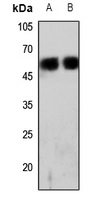 1 - Anti-CD224 HC Antibody AP60152