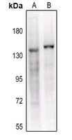 1 - Anti-CD41 HC Antibody AP60154