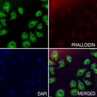 3 - Anti-Collagen 1 alpha 1 Antibody AP60156