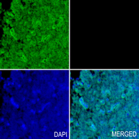 19 - Anti-Collagen 1 alpha 1 Antibody AP60156