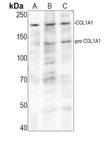 1 - Anti-Collagen 1 alpha 1 Antibody AP60156