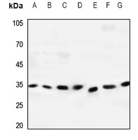 1 - Anti-Dectin 2 Antibody AP60157
