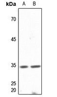 1 - Anti-DNAJB2 Antibody AP60158