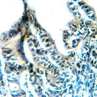 19 - Anti-DNMT3A Antibody AP60159
