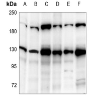 1 - Anti-DNMT3A Antibody AP60159
