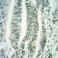 19 - Anti-EIF2S2 (Phospho-S67) Antibody AP60161
