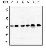 1 - Anti-ENT2 Antibody AP60163