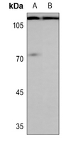1 - Anti-Enterokinase LC Antibody AP60164