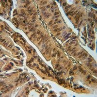 19 - Anti-EYA1 Antibody AP60165
