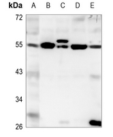 1 - Anti-EYA1 Antibody AP60165