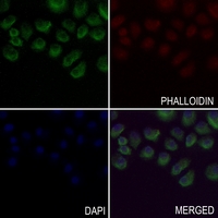 3 - Anti-Factor IX LC Antibody AP60166