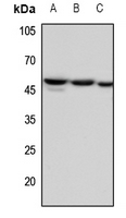 1 - Anti-Factor IX LC Antibody AP60166